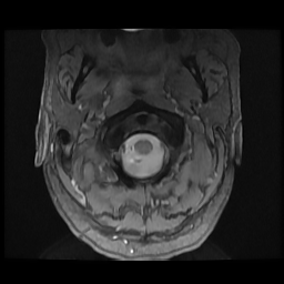 Browser-based medical imaging viewer showing an MRI scan slice, a custom web app built by Concho Catalyst
